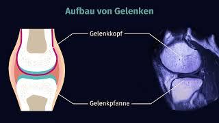 Gelenke – Bau und Typen einfach erklärt | sofatutor