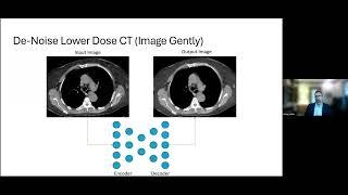 AI4C Lecture Series: Image Intelligently - Applications and Challenges in Pediatric Imaging