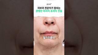 10초 만에 팔자주름 없애는 방법! 정말 효과 있을까? #장영란 #팔자주름 #마사지