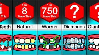 Comparison: Different Types Of Teeth