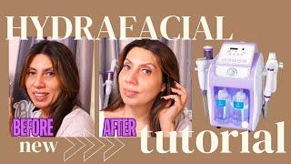 Honest Review | Mychway Hydro Dermabrasion Machine For Home Use Instant Glowing Skin [HYDRAFACIAL]