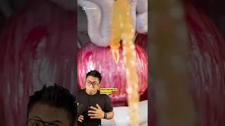 Suka Tahan Air Kencing?