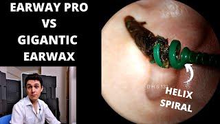 EarWay Pro VS Gigantic Ear Wax Plug (2nd Review)