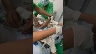 Intubation by using video laryngoscope.  #anaesthesia #medical #airwaymanagement #hospital