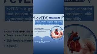 Cardiac-Valvular Ehlers-Danlos Syndrome (cvEDS) Signs & Symptoms - #shorts