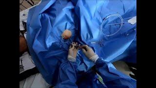 PTGBD insertion Cholecystostomy tube insertion 경피적 담낭조루술