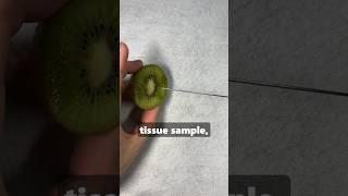 How To Use A Cancer Biopsy Needle In 30 Seconds! #medicine #surgeon #doctor #radiology
