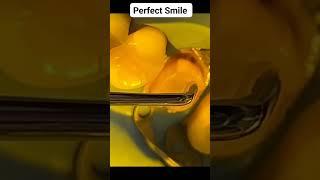 Dental Health Care | Dr. Wasif Rashid | Dentist | #foryou #shorts