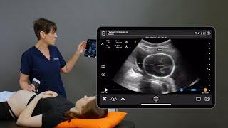 2nd Trimester Head Measurements
