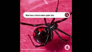 What Does A Black Widow Spider Bite Feel Like?