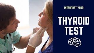 What is Thyroid  Profile Test: T3/Free T3,T4/ Free T4 ,TSH :Normal Range &Interpretation -Dr Kasi MD