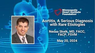 Aortitis, A Serious Diagnosis with Rare Etiologies | Nedaa Skeik, MD, FACC, FACP, FSVM