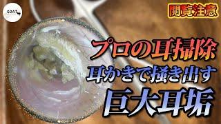 【プロの耳掃除】巨大耳垢！出てくる爽快感！衝撃耳かき動画！