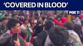 Teen stabbed during LA ICE protest