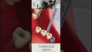 2024 #name of game role Easygoing Gaming Pleasures: Cleaning Teeth #CasualGaming