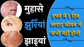 मुहासे झुर्रियां झाइयां करें खत्म | Home facial for glowing skin | Ranu Patel