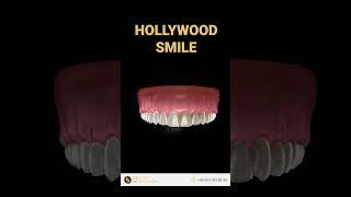 Get the Perfect Hollywood Smile: Unveiling the Secrets to a Dazzling Transformation!#shorts #turkey