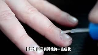 肝血不足睡眠差 一个中成药益气补血助睡眠