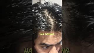 Best hair care routine for men | Hair fall | Hair loss