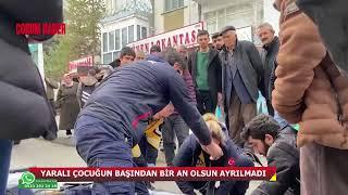 YARALI ÇOCUĞUN BAŞINDAN BİR AN OLSUN AYRILMADI