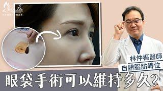 【美貌知尋識EP.19眼袋手術到底可維持多久呢？】眼袋手術最重要的是處理「這個地方」！#眼袋手術 #眼袋補脂