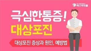 초여름 감기 몸살 증상이  대상포진 때문 일 수 있다?!