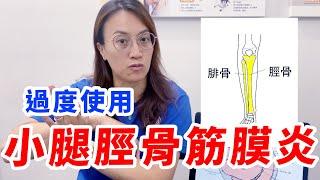 過度運動藏危機！步態不正確恐造成小腿脛骨筋膜炎！ | ft.張正琪物理治療師