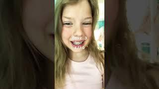 How my braces feel on the first day