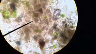 Microscopic Organisms in Pond Water