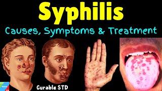 Syphilis – Symptoms, Causes, Pathophysiology, Diagnosis, Treatment, Complications, Preventions