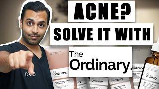 Doctor Recommends The Ordinary for Acne Solutions