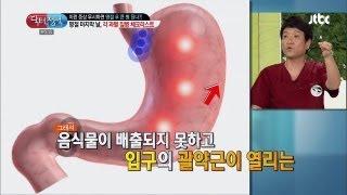 더 이상 급체는 민간의학에 의지하지 않아도 돼! 닥터의 승부 91회