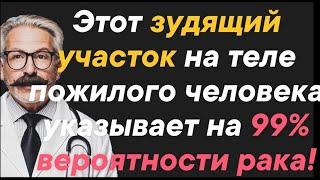 Этот зуд у пожилых: указывает на 99% риск рака.