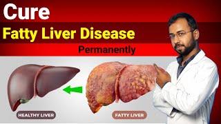 Fatty liver treatment grade 1 2 3 | fatty liver symptoms exercise diet | fatty liver ke lakshan