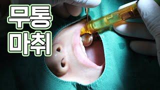 치과 공포증 있으신 분들께 희소식! 마취 안 아프게 해드립니다