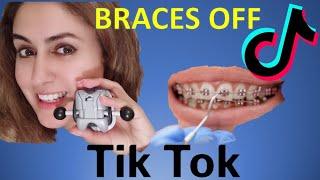 Orthodontist Reacts to Getting Braces Off Tik Tok's! (Part 3)