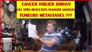 MES 1ERS RESULTATS SCANNER CANCER VOILIER JOHNNY SUN ODYSSEY 29.2  CLABI JOJO