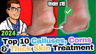 How to REMOVE Thick Dry Skin, Calluses & Corns [HOME Remedies]