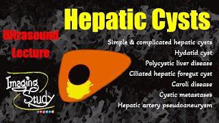 Hepatic Cysts || Cystic Lesions || Ultrasound Lecture || Imaging Study