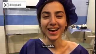 Her nose drops when she laughs!
