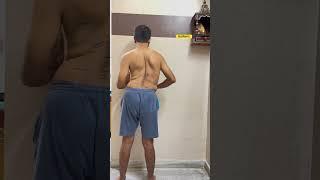 The Powerful Spider-Man Exercise For Scoliosis Cases #scoliosistreatment #spine #india #physio