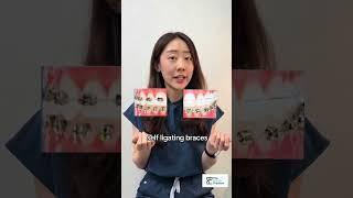 Self-ligating versus traditional braces #orthodontist #dentist #bracesadjustment