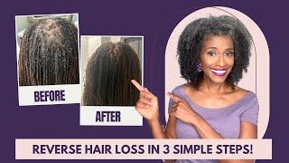 How to Reverse Hair Loss: 3 Proven Strategies