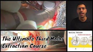 The Third Molar Experience - The Ultimate Wisdom Tooth Extraction Course