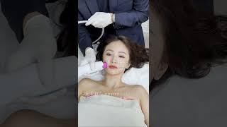 Thermage FaceLift SG | 新加坡热玛吉肌肤提拉紧致 | Define Aesthetic Medical Clinic