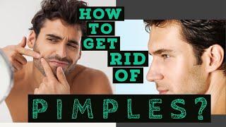 How To Get Rid of PIMPLES? Pimple Problem Solve | Varun Verma (Part 1)