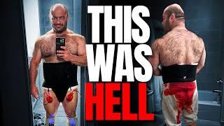 My Brutal Physique-Altering Surgery Experience  (Graphic Medical Content)