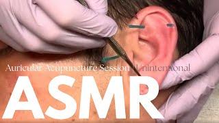 [ASMR] Auricular (Ear) Acupuncture Treatment | Real Person ASMR  ft. Tom