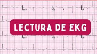 E10 - LECTURA DE EKG: Integración | Cardiología