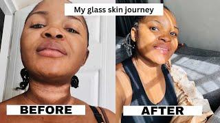 How I got rid of stubborn hyperpigmentation and my skincare products